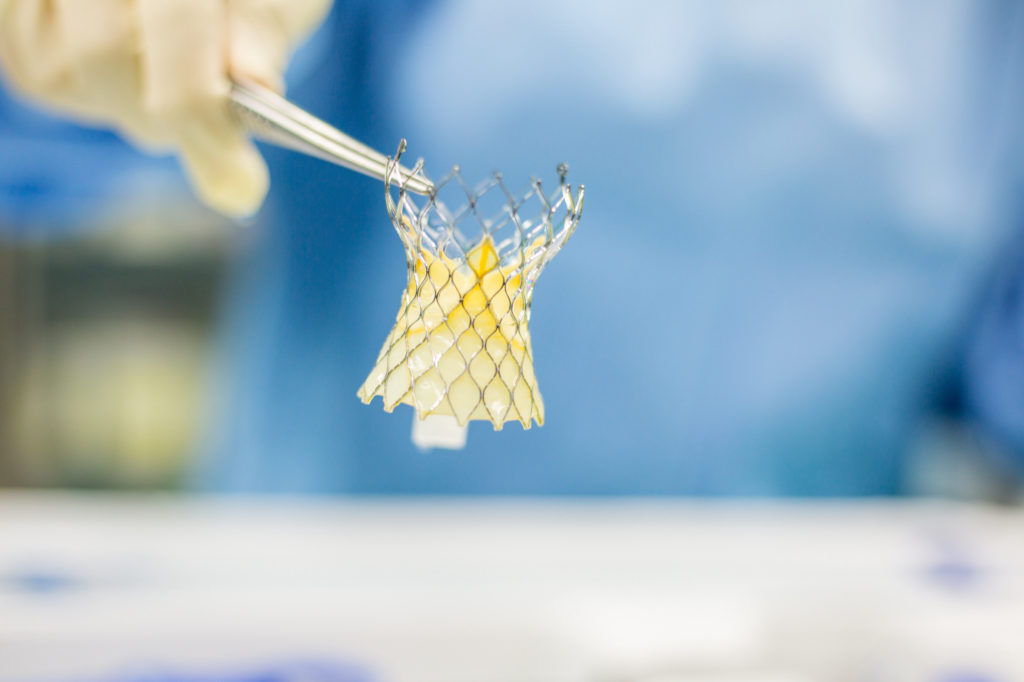 Heart valve surgery cardiology for patient in hospital